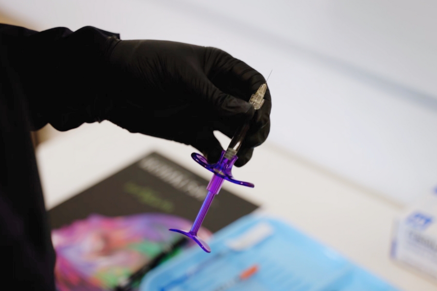 Jeringa ergonómica MONALISA con lidocaína 0.3 % para aplicación precisa y segura en medicina estética