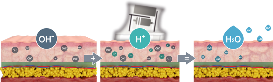 Terapia de Hidrógeno proceso